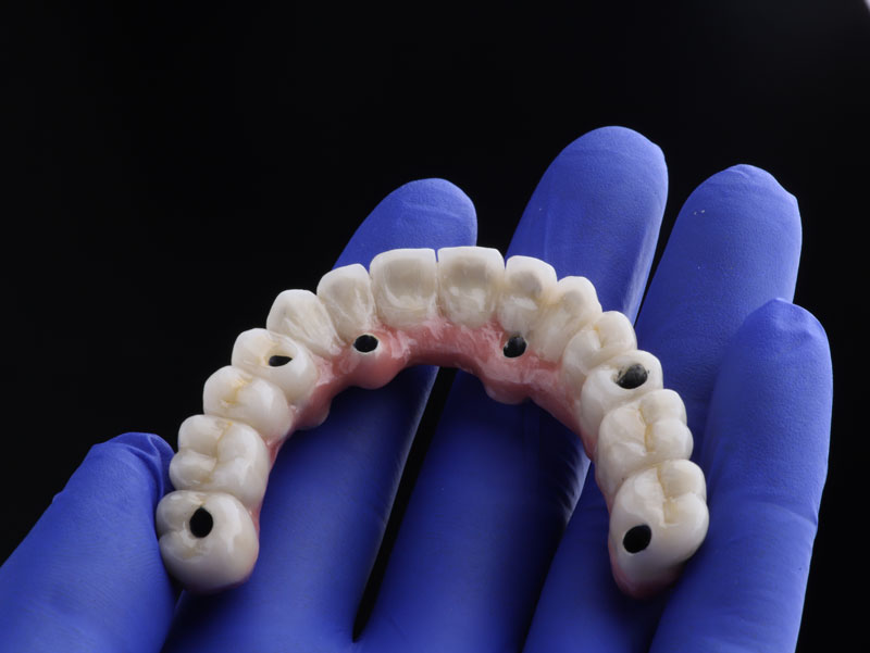 Navigating the World of Dental Implant Surgery in Jacksonville, FL