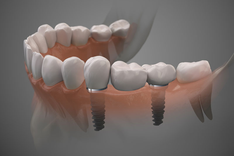 Unearth the Secret of Healthy Smiles with the Best Dentist in Jacksonville, FL