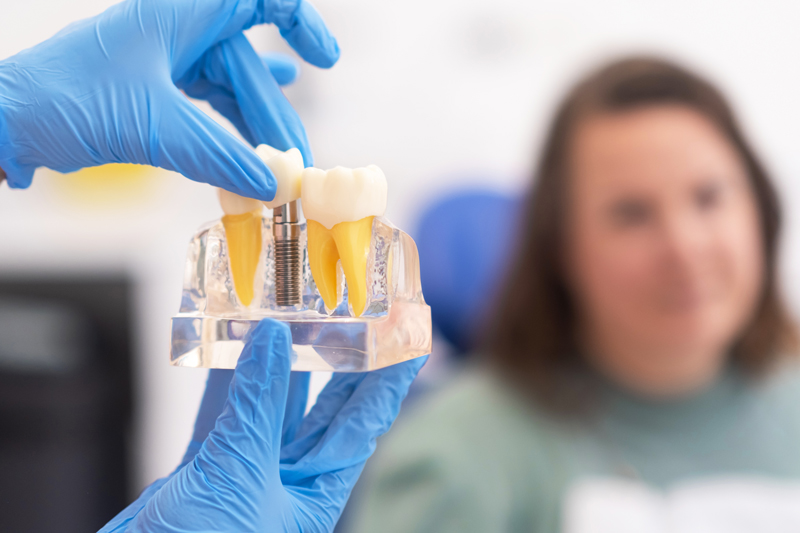 An In-Depth Guide: Implants Denture v/s Traditional Dentures