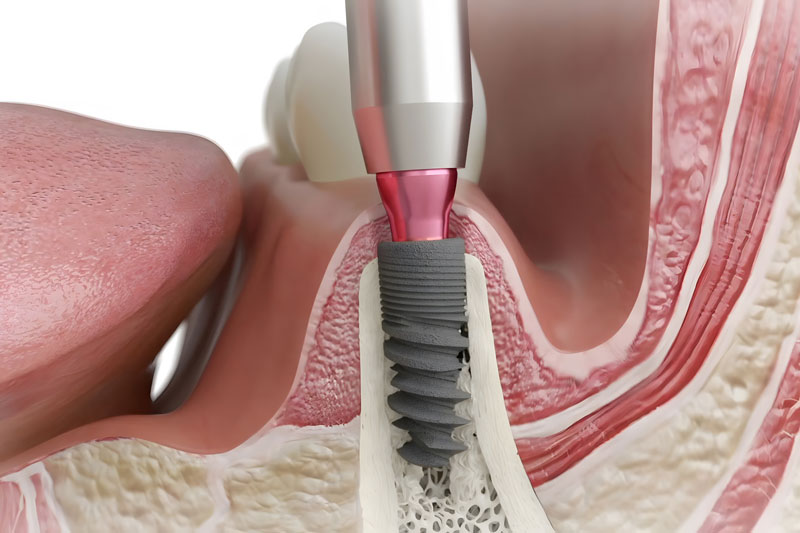 Discovering Jacksonville’s Dental Scene: A Comprehensive Look at Services with Dr. Michael Spencer