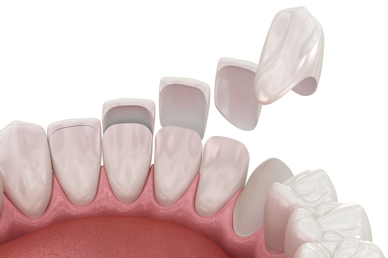 Revitalize Your Smile: A Comprehensive Guide to Cosmetic Dentistry in Jacksonville, FL